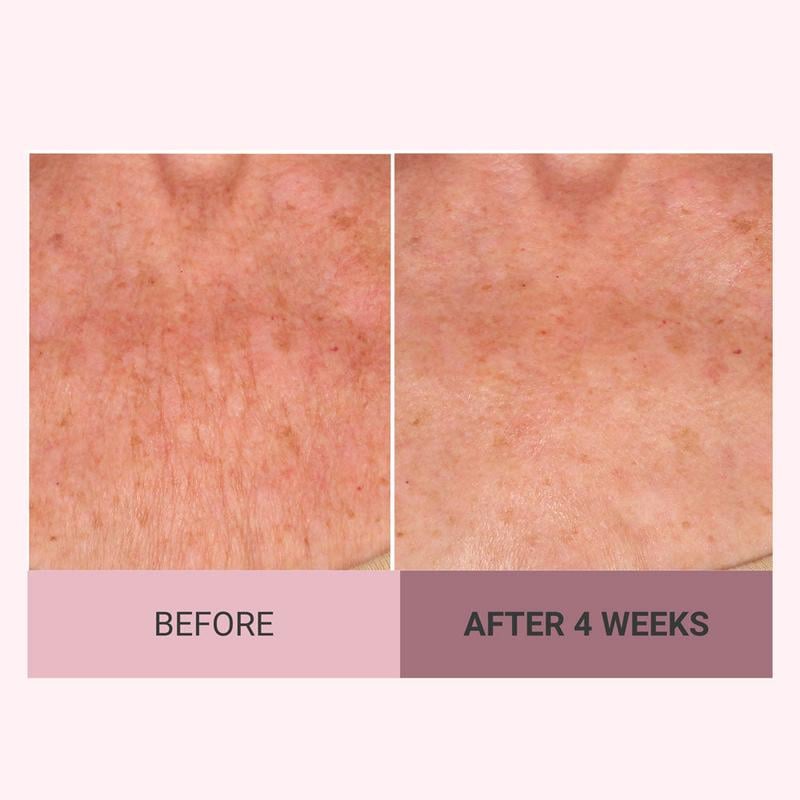 Natravor™  Experience Ultimate Luxury - 49% OFF -  Champagne Beaute Lift Firming Body Crème - For Firmer, Smoother, Radiant Skin!