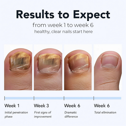 Natravor™ Fungal Nail Renewal Patches