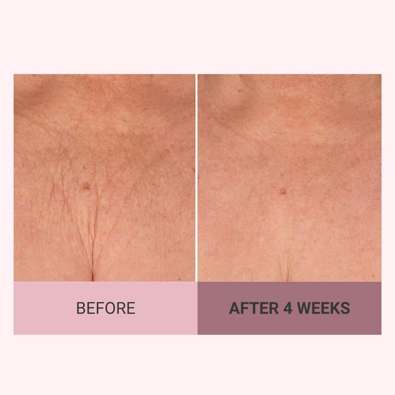 Natravor™  Experience Ultimate Luxury - 49% OFF -  Champagne Beaute Lift Firming Body Crème - For Firmer, Smoother, Radiant Skin!