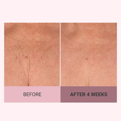 Natravor™  Experience Ultimate Luxury - 49% OFF -  Champagne Beaute Lift Firming Body Crème - For Firmer, Smoother, Radiant Skin!