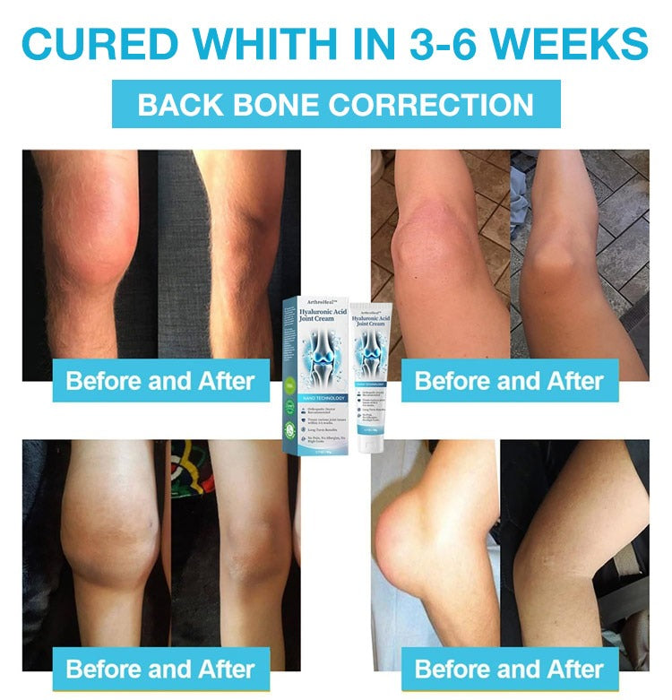 Natravor™ Hyaluronic Acid Joint Repair & Relief Cream – Fast‑Absorbing 50 g