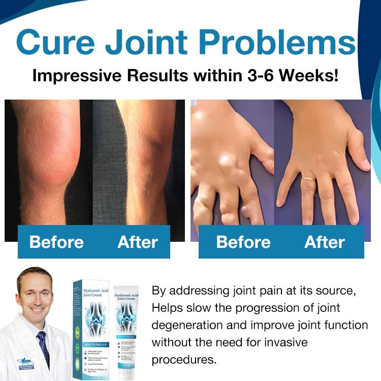 Natravor™ Hyaluronic Acid Joint Repair & Relief Cream – Fast‑Absorbing 50 g