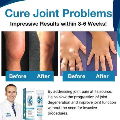 Natravor™ Hyaluronic Acid Joint Repair & Relief Cream – Fast‑Absorbing 50 g